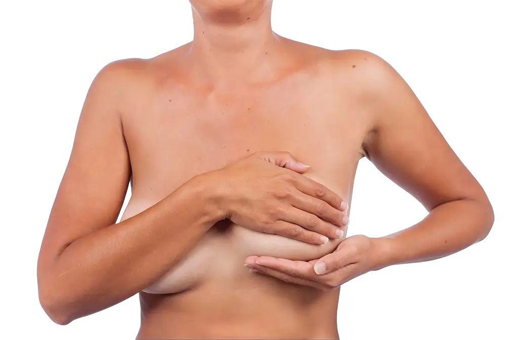 הרמת שדיים